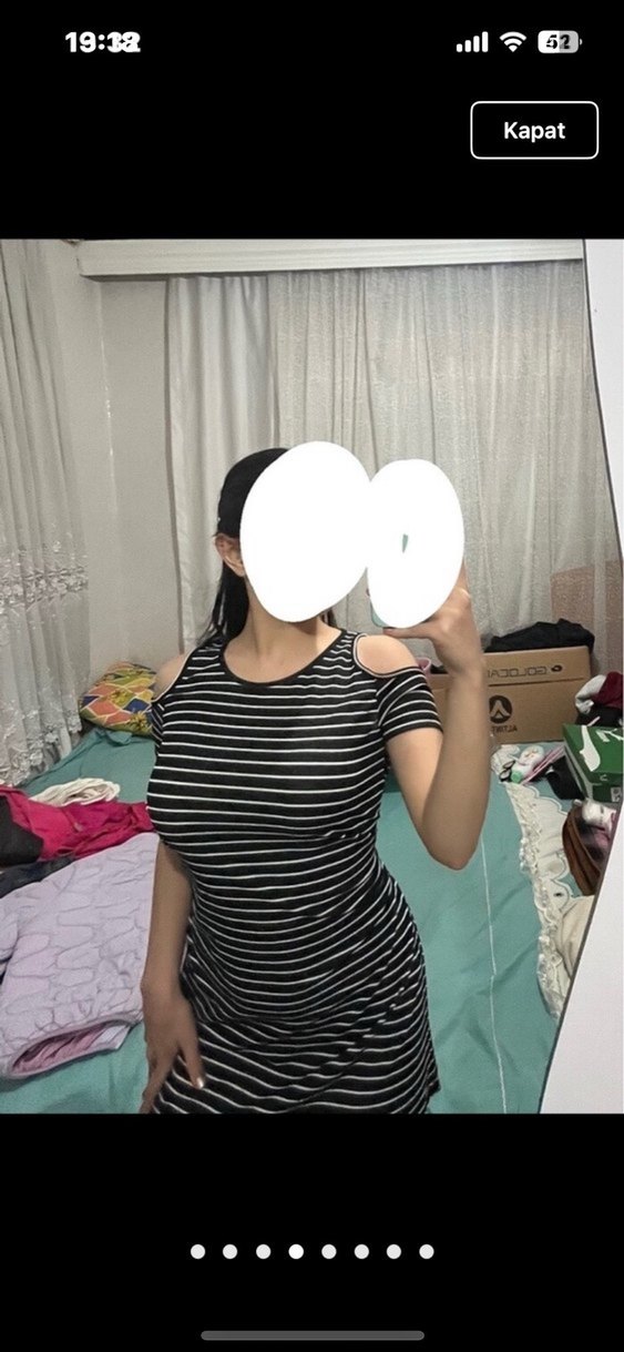 Çizgili Siyah Mini Elbise - Görsel 4