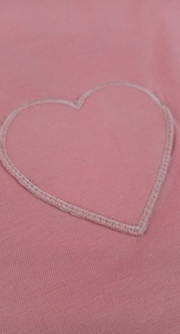 Pembe Kız Çocuk Fırfırlı Elbise - Görsel 4