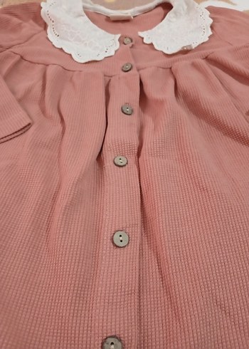 Düğmeli Pembe Kız çocuk elbise - Görsel 2