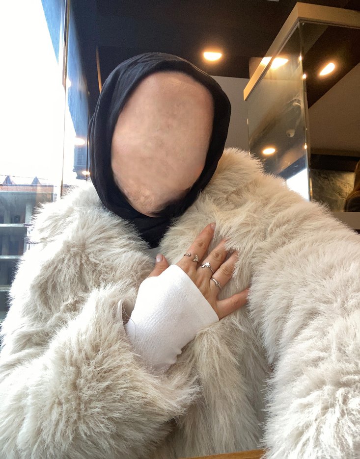 Uzun kürk - Görsel 2