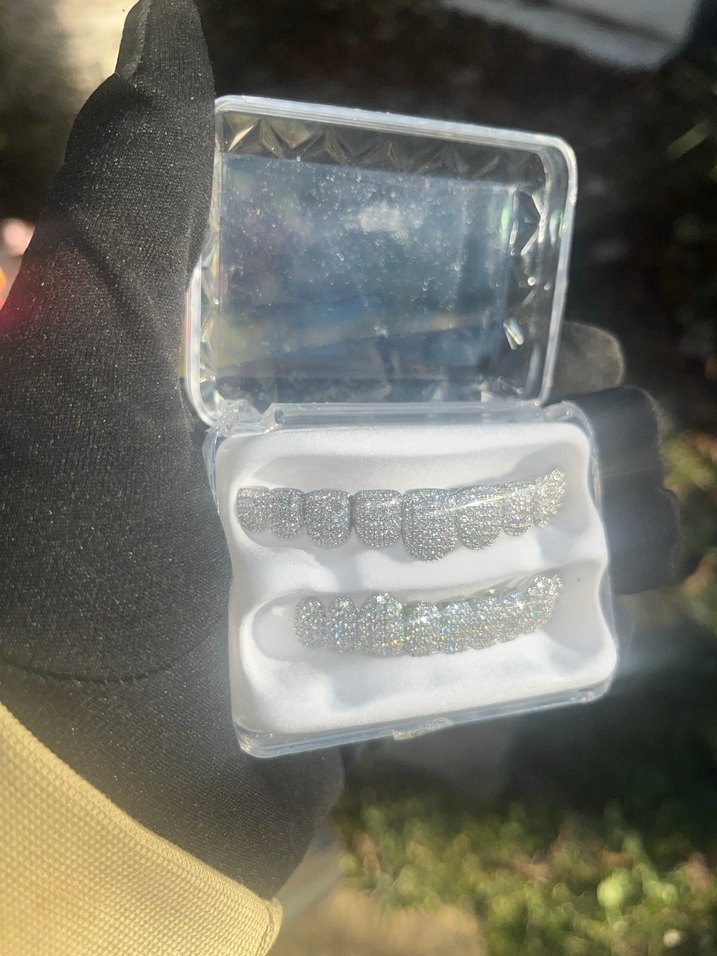 İced Out Grillz - Görsel 2