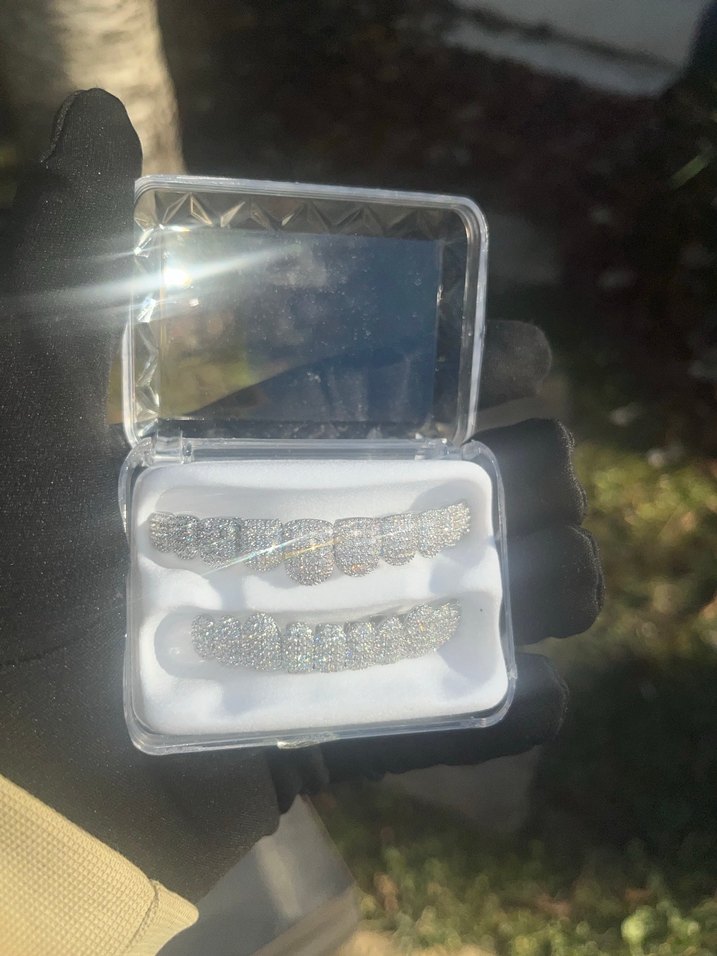 İced Out Grillz - Görsel 3