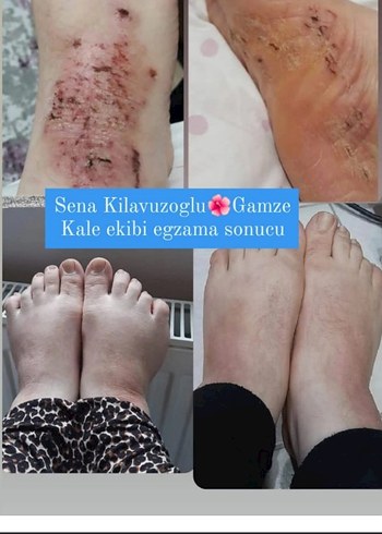 Erkek Saç Serumu ve Maskesi - 1 Aylık Kullanım Sonucu - Görsel 4