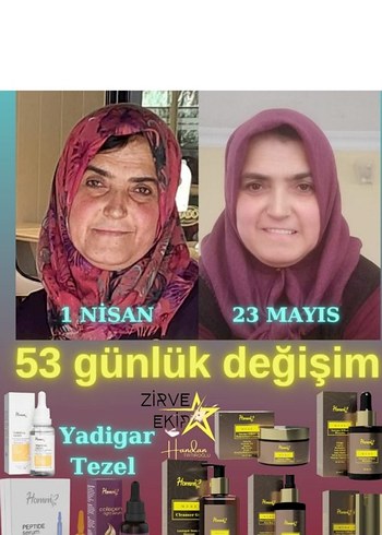 Erkek Saç Serumu ve Maskesi - 1 Aylık Kullanım Sonucu - Görsel 9