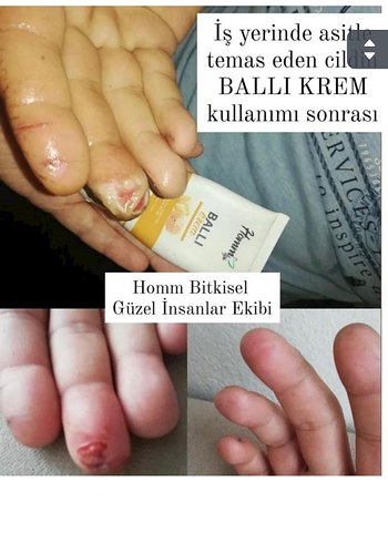 Erkek Saç Serumu ve Maskesi - 1 Aylık Kullanım Sonucu - Görsel 5