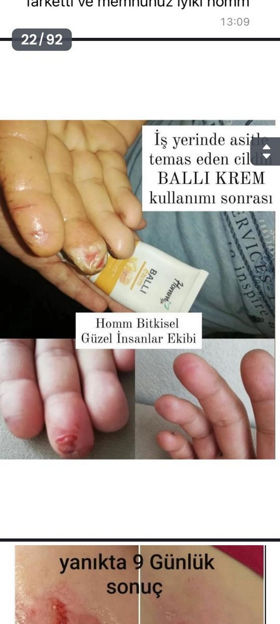 Erkek Saç Serumu ve Maskesi - 1 Aylık Kullanım Sonucu - Görsel 5