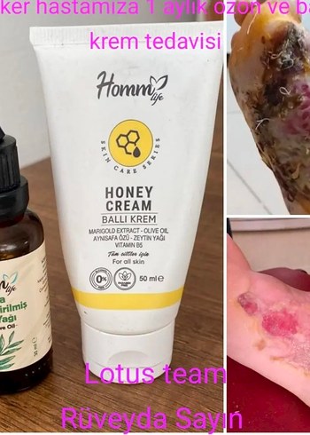 HOMM LIFE OZONLA ZENGİNLEŞTİRİLMİŞ ZEYTİNYAĞI 30 ML - Görsel 4