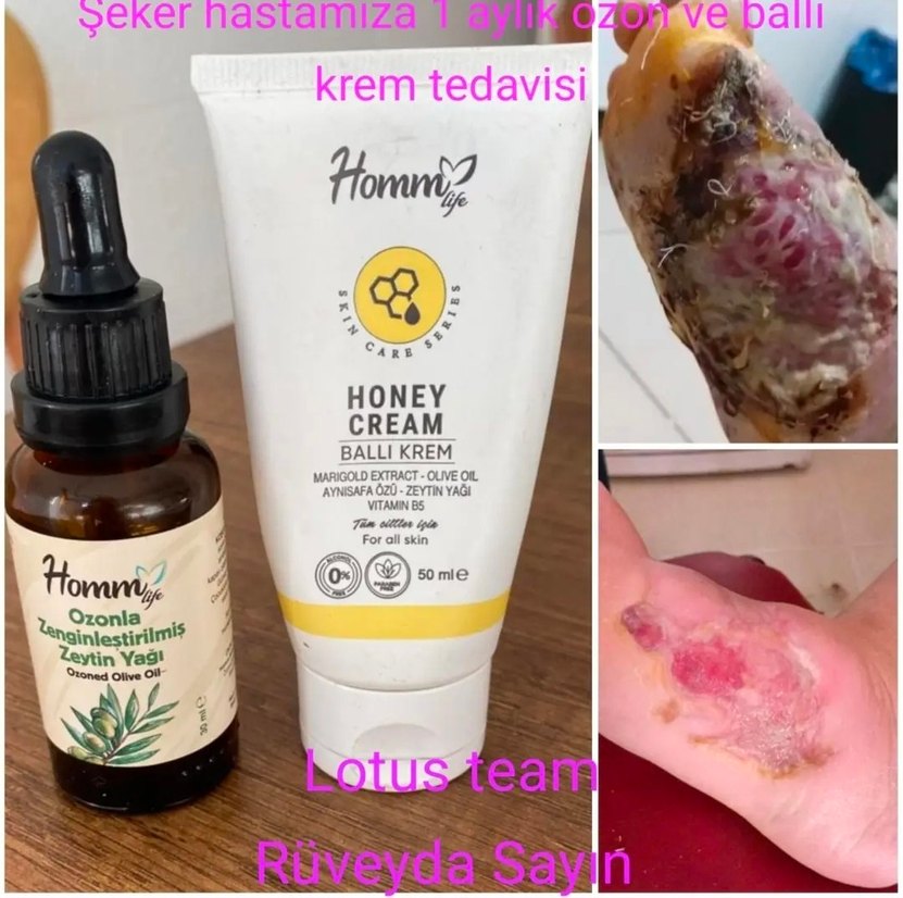 HOMM LIFE OZONLA ZENGİNLEŞTİRİLMİŞ ZEYTİNYAĞI 30 ML - Görsel 4