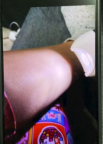 Epilatör Seti - Görsel 3