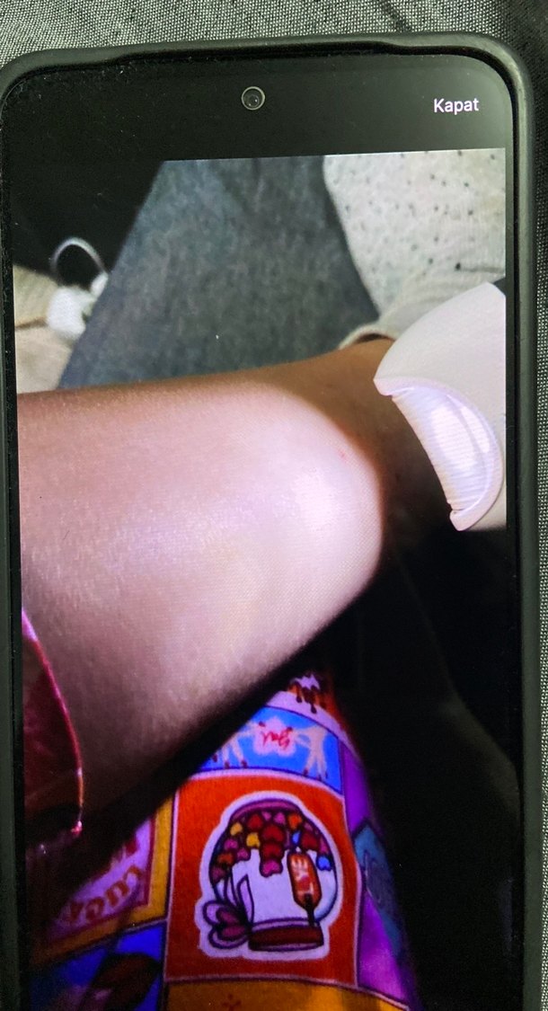 Epilatör Seti - Görsel 3