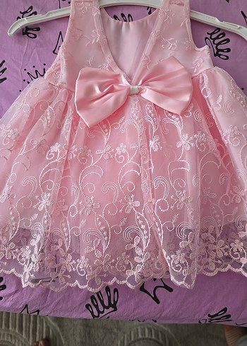Dantel Detaylı Pembe Kız Elbisesi - Görsel 2