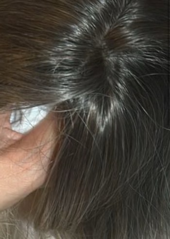 Tepelik Peruk - Görsel 6