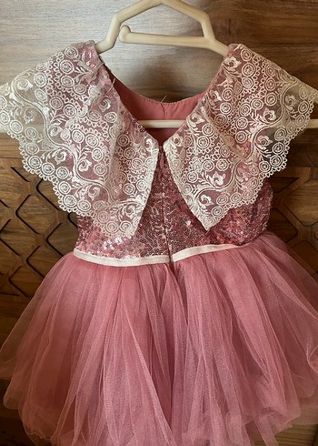 Dantel Detaylı Pembe Kız Çocuk Elbise - Görsel 2