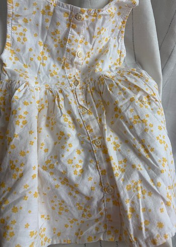 Sarı Çiçek Desenli Kız Elbisesi - Görsel 3
