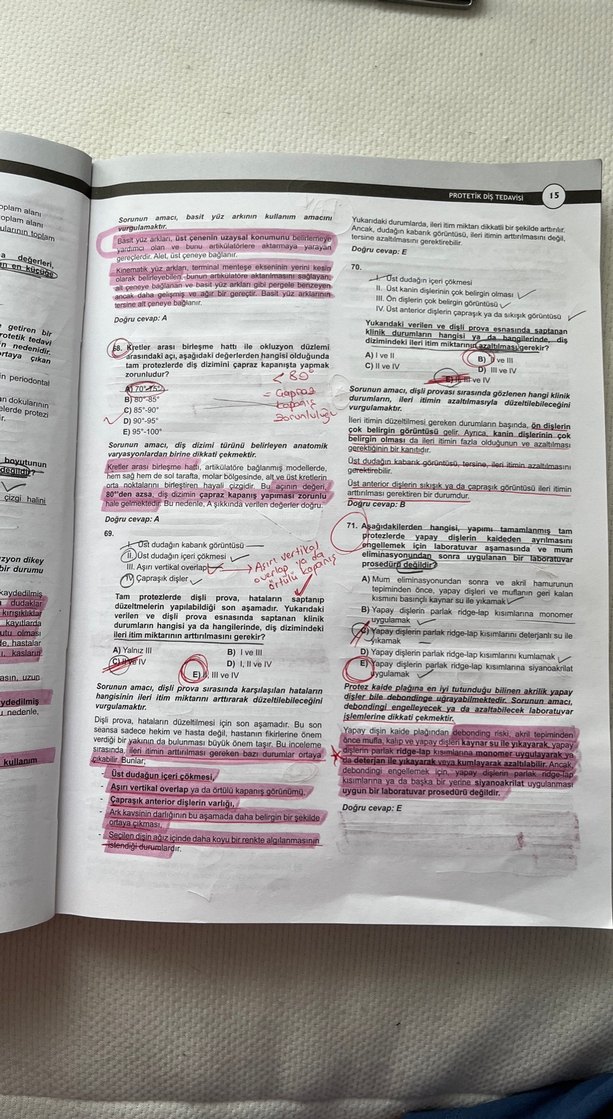 DUS Protetik Diş Tedavisi Soru Serisi Kitabı - Görsel 4