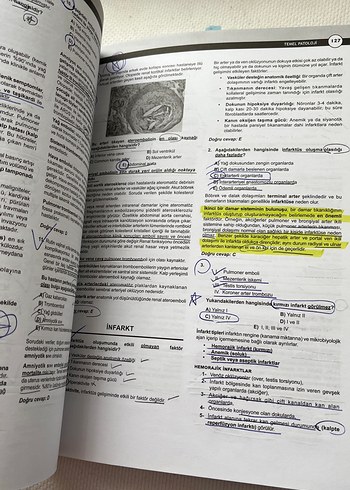 DUS Akademi Temel ve Oral Patoloji Soruları 4. Baskı - Görsel 5