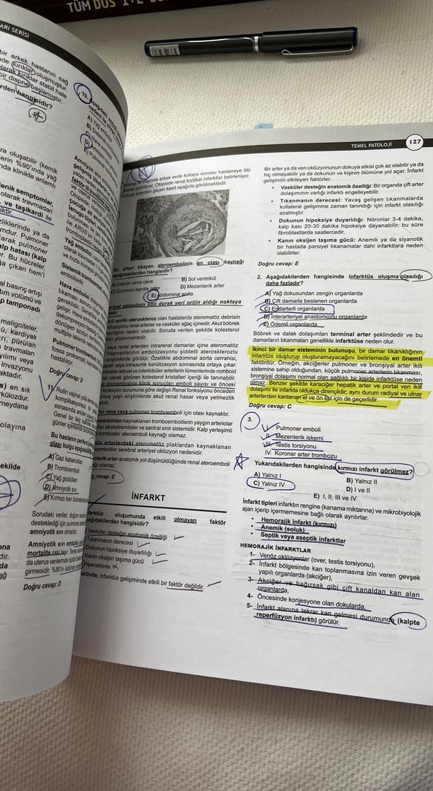 DUS Akademi Temel ve Oral Patoloji Soruları 4. Baskı - Görsel 5