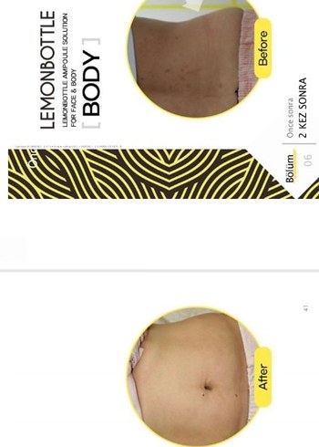 Lemon Bottle yağ yakıcı Solüsyon - Görsel 3