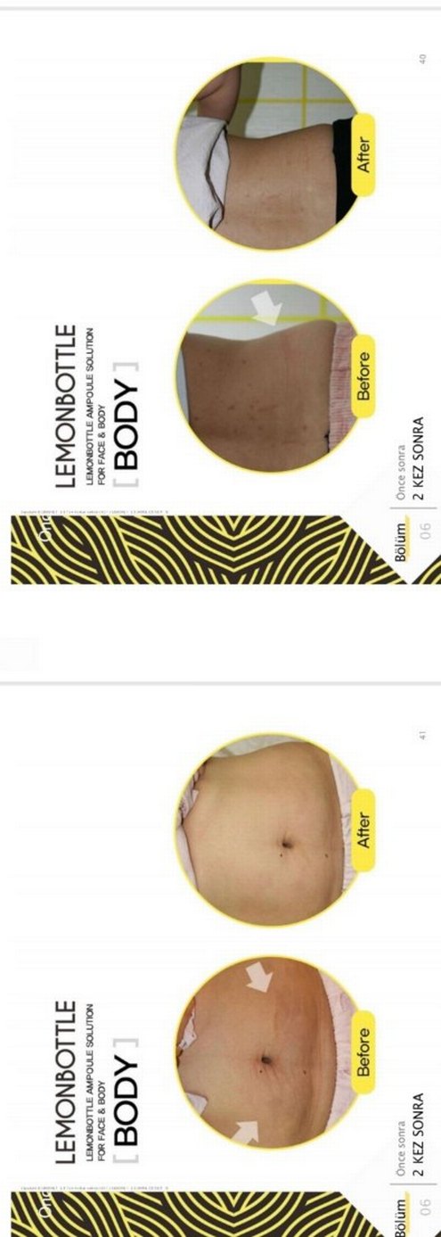 Lemon Bottle yağ yakıcı Solüsyon - Görsel 3