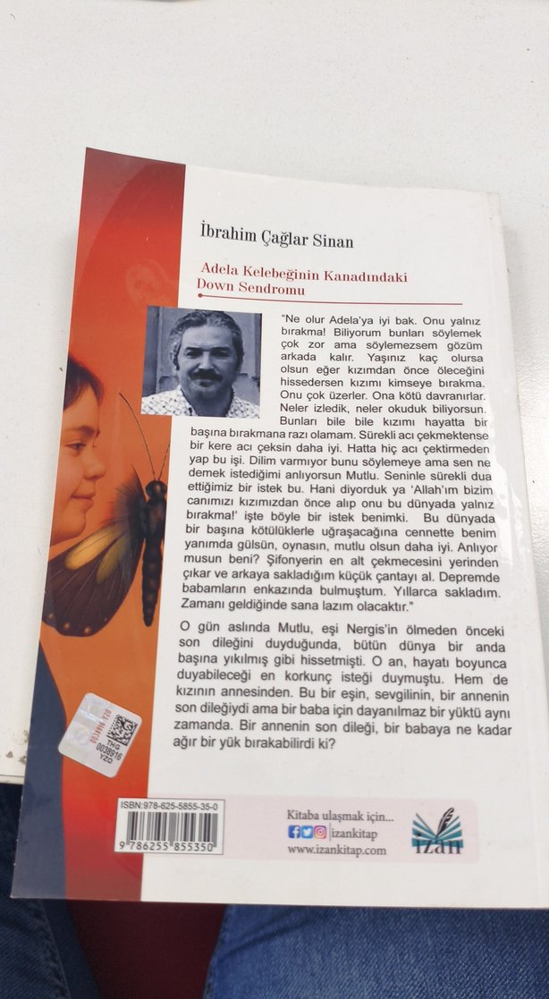 Adela Kelebeğinin Kanadındaki Down Sendromu - Görsel 2