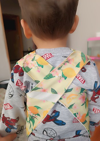 Sarı Desenli Bebek Önlüğü - Görsel 2