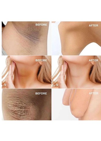 Kanza beyazlatıcı  Krem Seti - Görsel 4