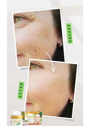 Kanza beyazlatıcı  Krem Seti - Görsel 5