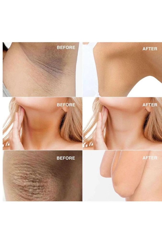 Kanza beyazlatıcı  Krem Seti - Görsel 4