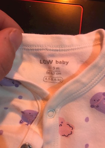 Bebek Kız Baskılı Düğmeli Hastane Tulumu - Görsel 2