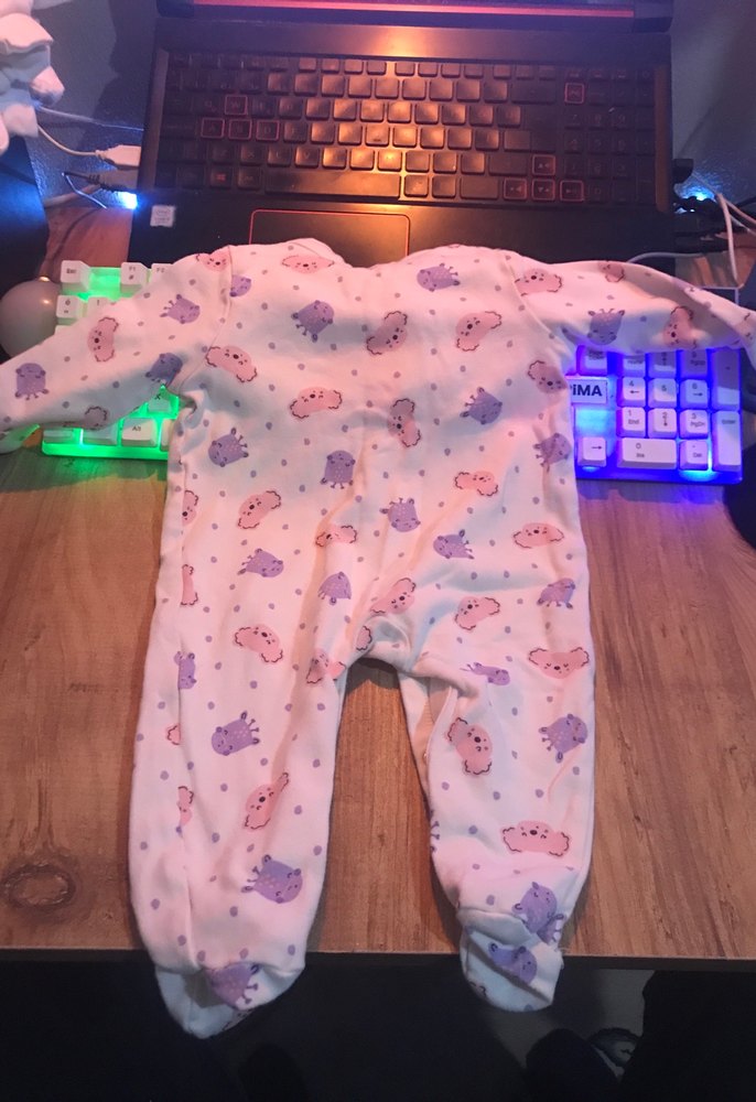 Bebek Kız Baskılı Düğmeli Hastane Tulumu - Görsel 3