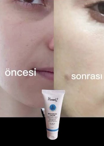 Homm Life Beyazlatıcı Krem 75 ml - Görsel 2