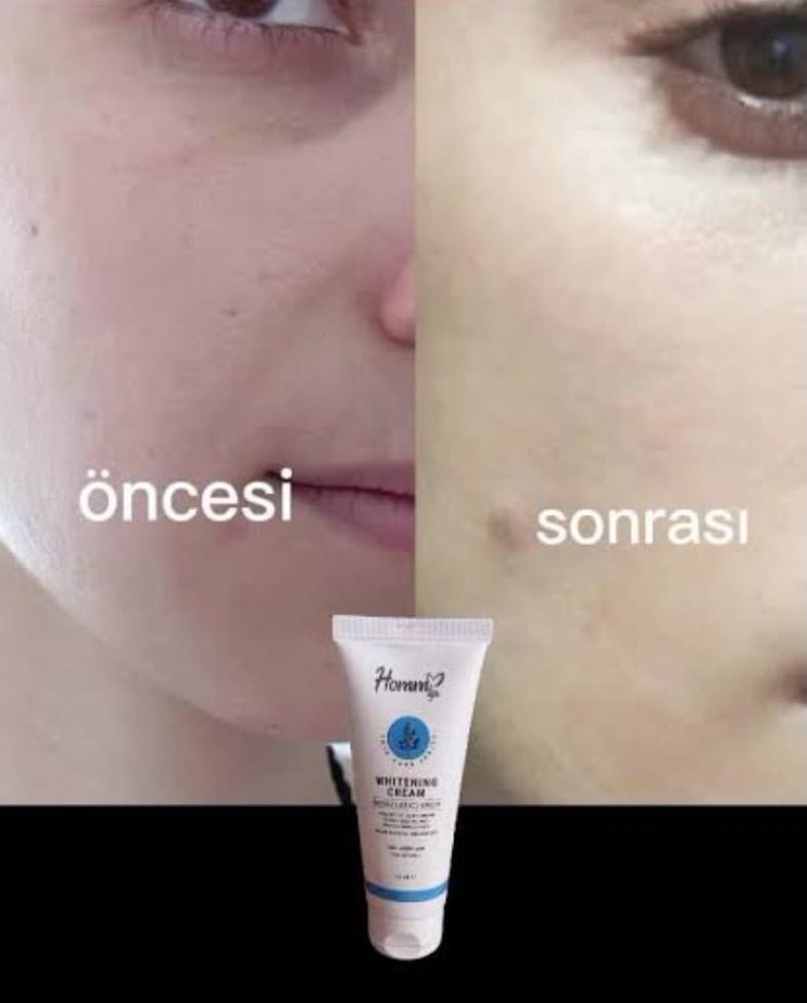 Homm Life Beyazlatıcı Krem 75 ml - Görsel 2