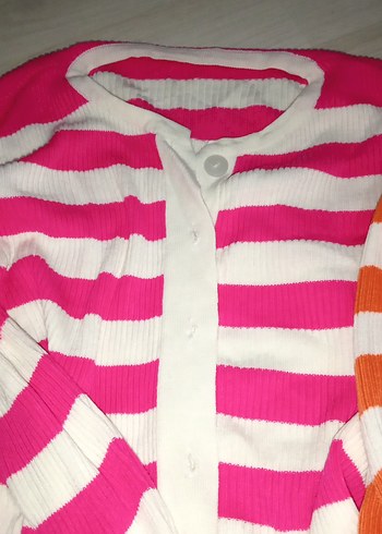 Renkli Çizgili Düğmeli Kıyafet - Görsel 2