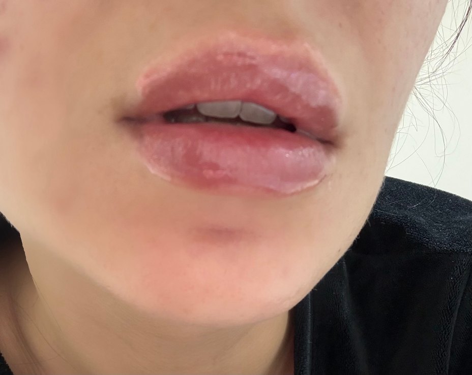 Rival Me Parlak Lipgloss - Görsel 3