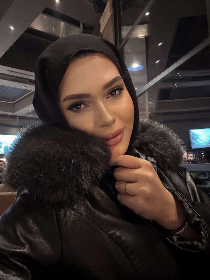 Kürklü Siyah Deri Kadın Ceket - Görsel 5