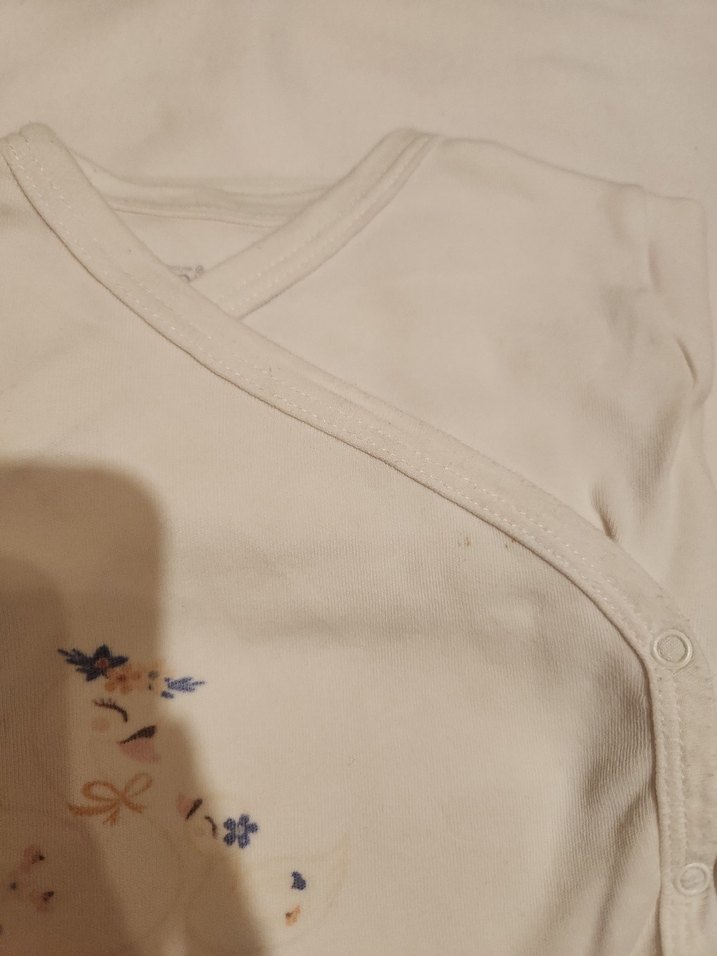 Bebek Kız Beyaz Hastane Kıyafeti - Görsel 2