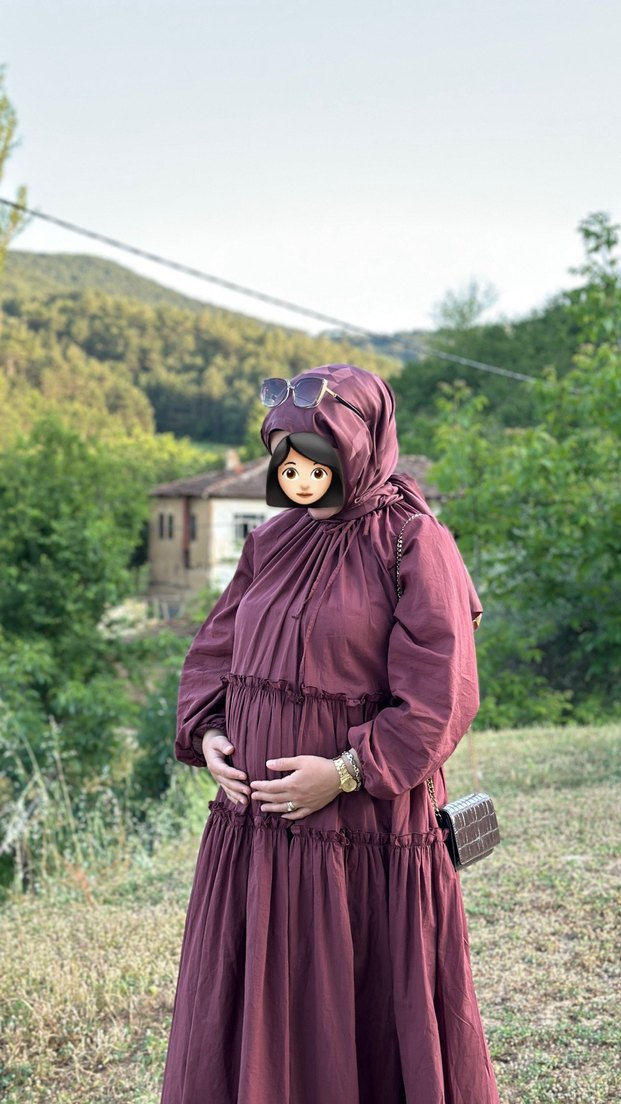 Aybikestil Elbise - Görsel 3