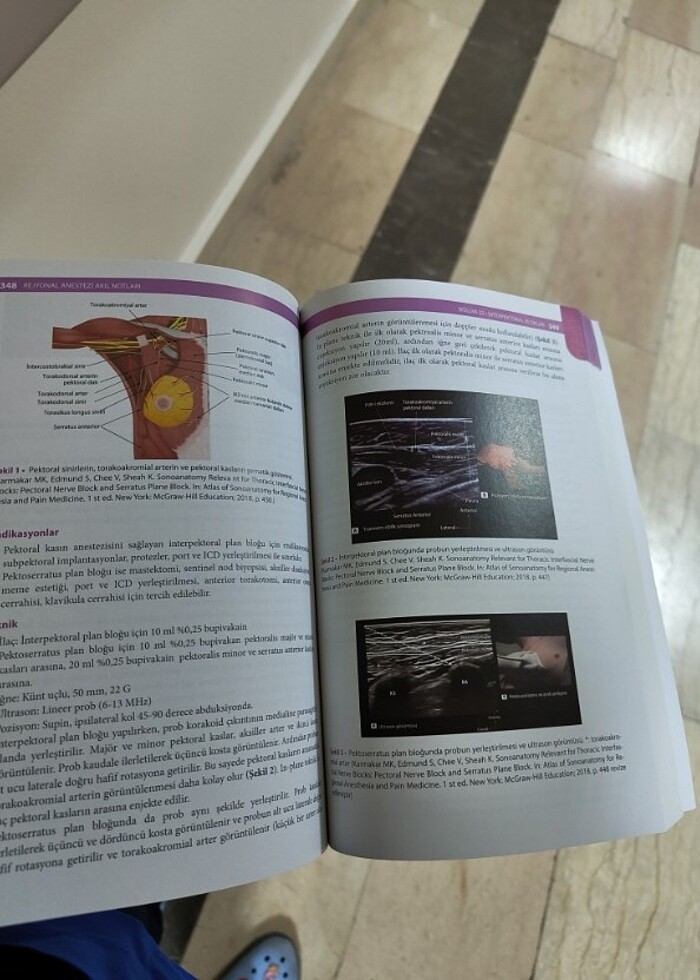 Rejiyonel anestezi  - Görsel 2