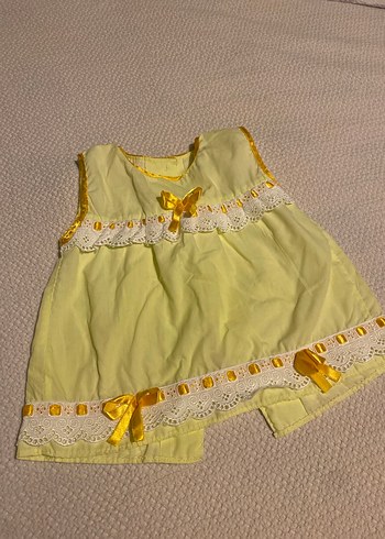 Sarı Dantel Detaylı Nakışlı Bebek Elbise
