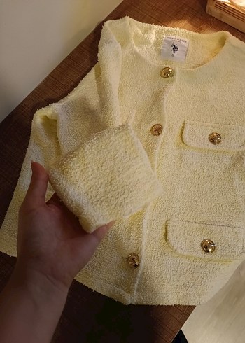 Düğmeli Sarı Kadın Midi Ceket - Görsel 2