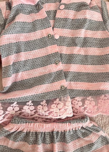 Pembe Gri Zebra Desenli Dantelli Bebek Kız Takımı - Görsel 2