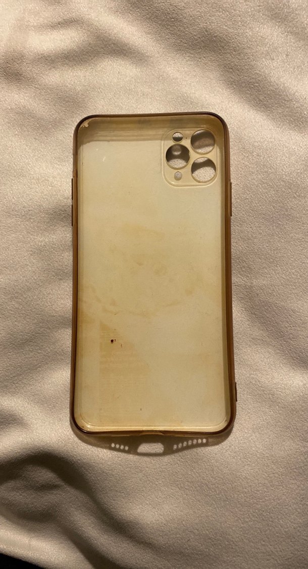 Mavi Butonlu Telefon Kılıfı - Görsel 2