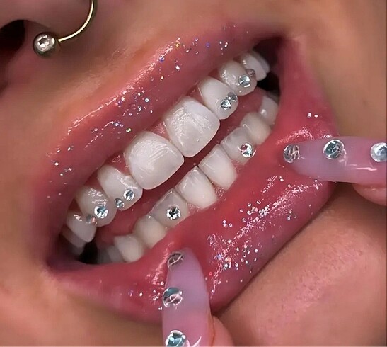 Y2k Coquette Kırmızı ve Beyaz Taşlı 40 Adet Teeth Grillz Gems Di - Görsel 2