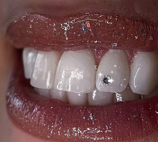 Y2k Coquette Kırmızı ve Beyaz Taşlı 40 Adet Teeth Grillz Gems Di - Görsel 3