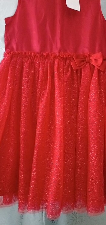 H&M Sikintilari yoktur