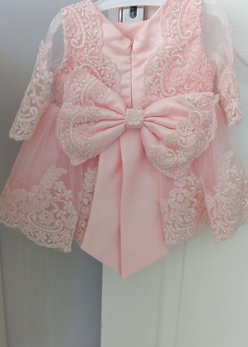 Pembe Dantel Detaylı Kız Çocuk Elbisesi - Görsel 6