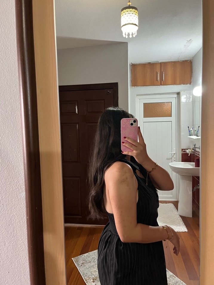 Siyah Askılı Mini Elbise - Görsel 3