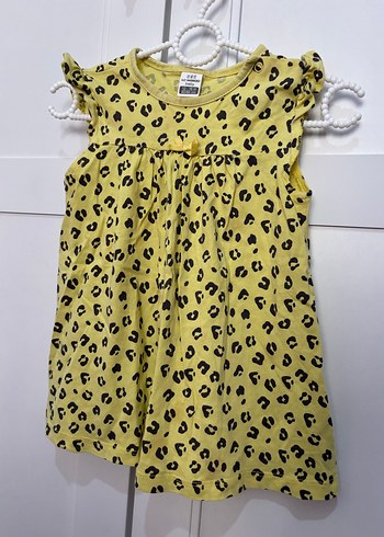 Sarı Leopar Desenli Kız Çocuk Elbise - Görsel 2