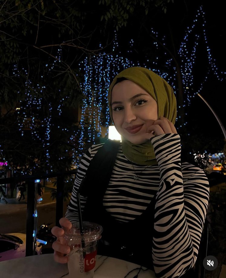 Zebra desen crop body - Görsel 2