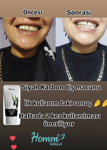 homm bitkisel dis macunu - Görsel 3